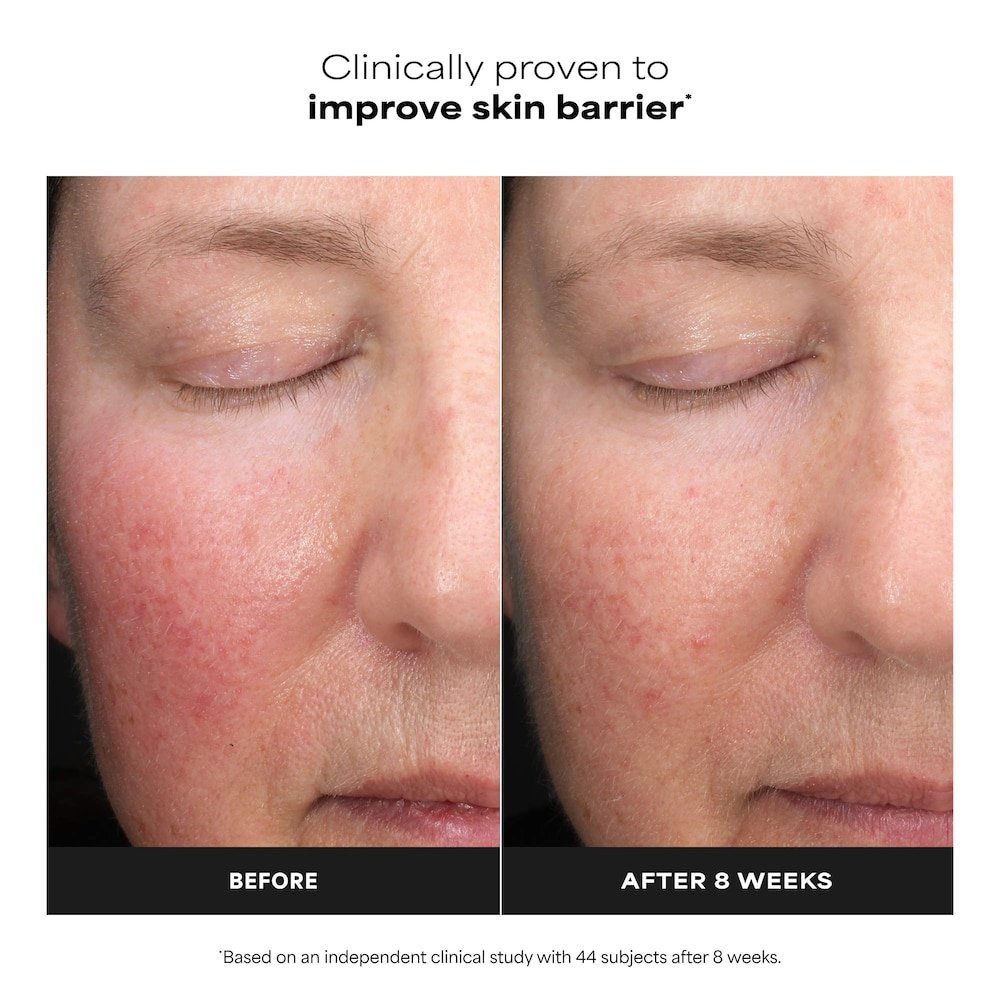 Paula's Choice 6% Mandelic Acid + 2% Lactic Acid AHA Liquid Exfoliant